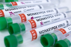 Picture of U.S. expects 300,000 more Jynneos doses as monkeypox cases jump to 45
